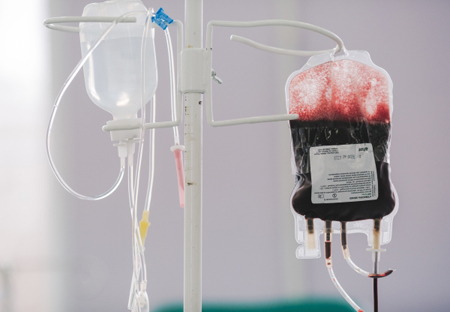 Новый метод остановки кровотечения впервые применили в столичной больнице