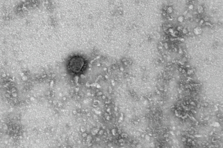 Еще у семи жителей Подмосковья выявлен коронавирус