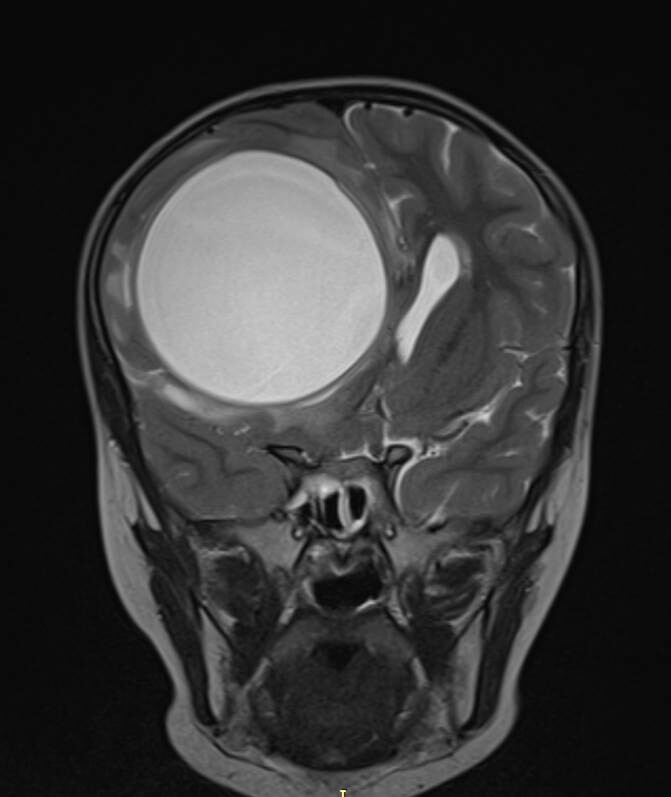 Снимок МРТ пациентки из соцсетей больницы