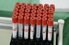 Около 3,5 тыс. случаев коронавируса выявлено в Поволжье за сутки