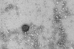 Академик Зверев: пандемия COVID-19 пойдет на спад, но "омикрон" не последняя фаза