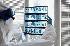 Случаи микоплазменной инфекции отмечены в Ростовской области