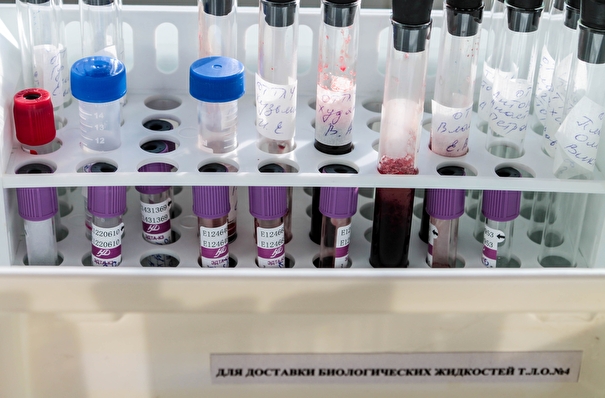 Москвичи смогут сдать бесплатные тесты на антитела к COVID-19 в 30 поликлиниках