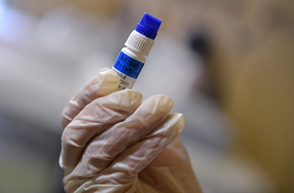 Свердловские власти заявили о случаях неоправданного повышения цен на тесты на антитела к COVID-19