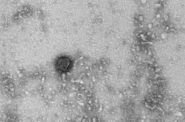 ФМБА: новые штаммы коронавируса можно будет выявить при помощи мазка