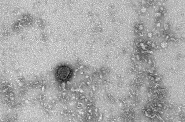 Доминирующему в мире дельта-штамму коронавируса труднее стать более патогенным - эксперт