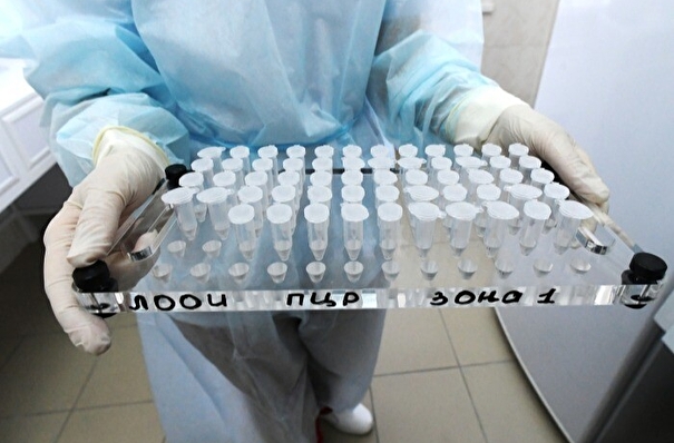 Более 2 тыс. заражений коронавирусной инфекцией зарегистрировали в Югре за сутки