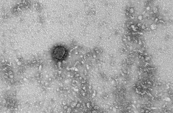 В Минобороны РФ заявили о возможной причастности США к появлению коронавируса
