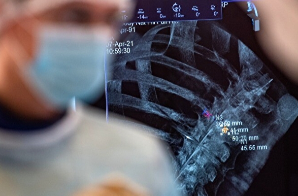 В Москве заработал новый сервис ИИ для диагностики перелома ребер