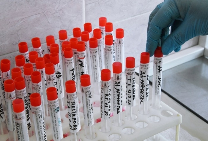Объем исследований на коронавирус в Башкирии увеличат до 5 тыс. в сутки