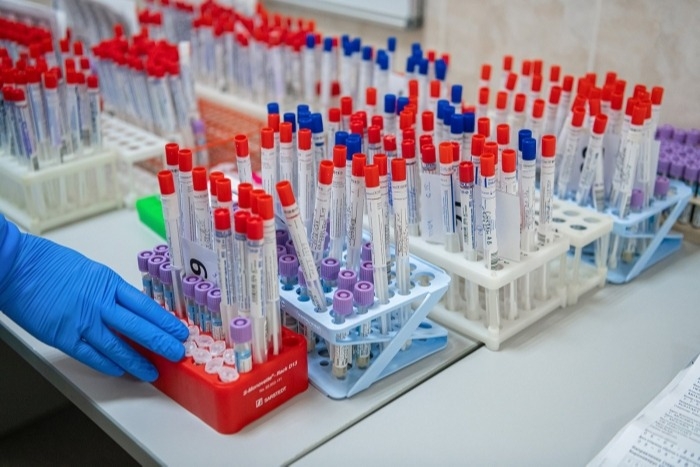 Роспотребнадзор: В РФ проедено свыше 5,9 млн тестов на коронавирус