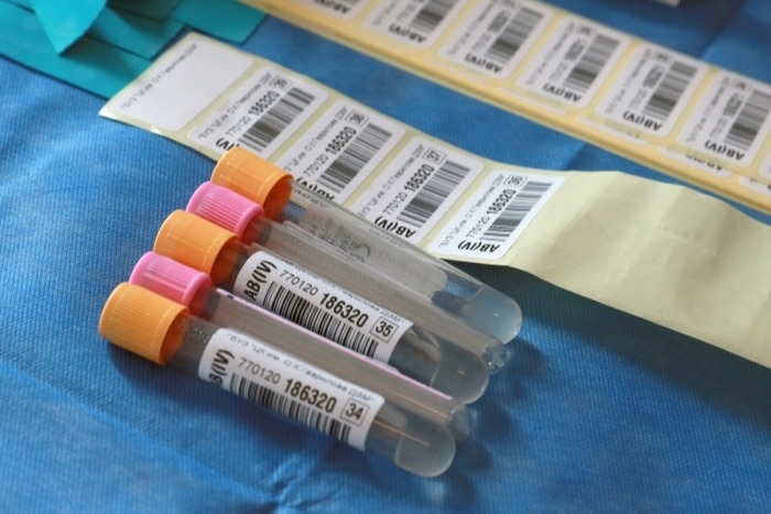 Жителей Ленобласти тестируют на иммунитет к COVID-19