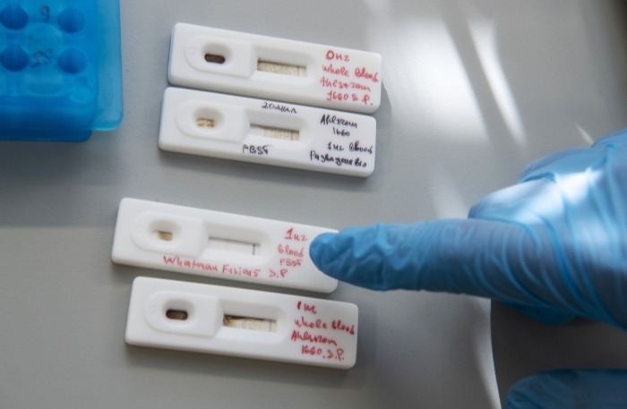 Более 10 тыс. экспресс-тестов для выявления коронавируса получат тюменские больницы