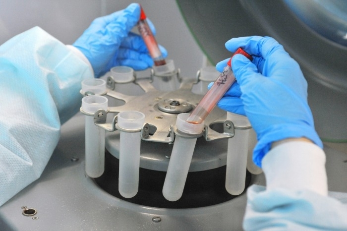 Проверить уровень антител после "ЭпиВакКороны" теперь можно в коммерческих лабораториях