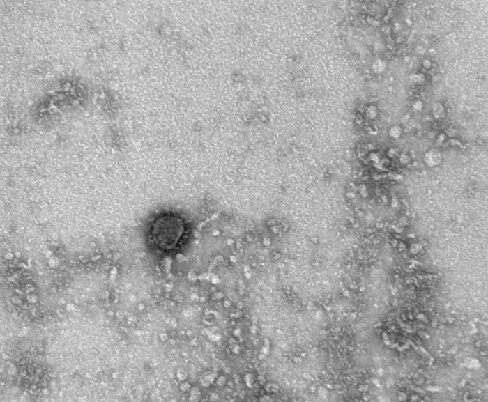 Доминирующему в мире дельта-штамму коронавируса труднее стать более патогенным - эксперт