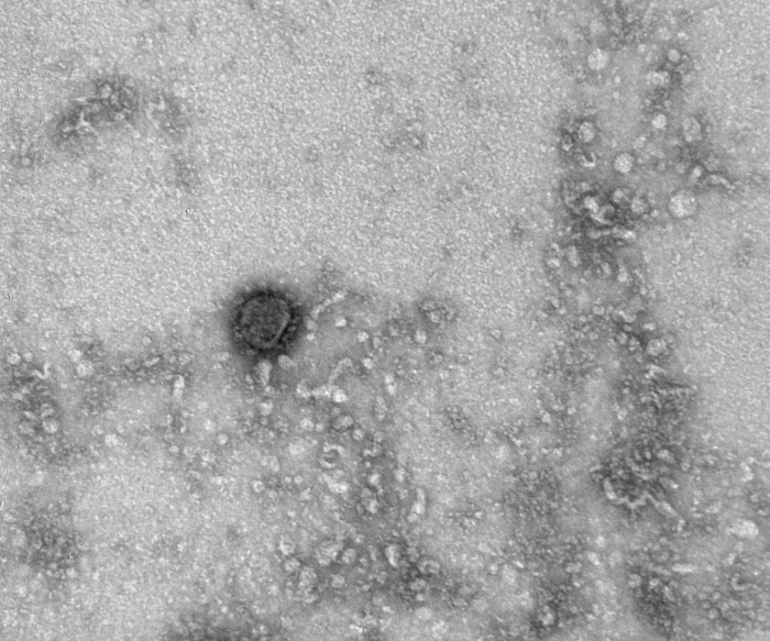 Три случая штамма коронавируса "мю" и один - штамма "лямбда" выявлены в РФ