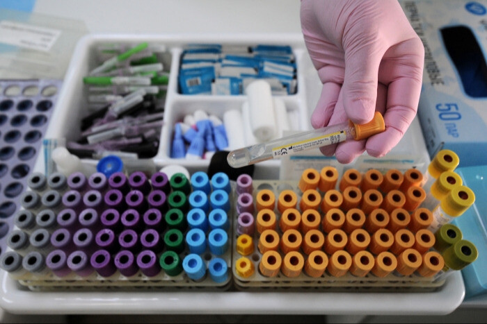 Российские ученые определят минимальный уровень антител, при котором необходимо делать вакцинацию - НИИ эпидемиологии