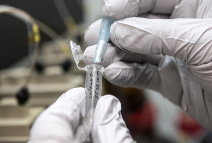 Первый случай заражения штаммом коронавируса "омикрон" выявлен в Оренбуржье