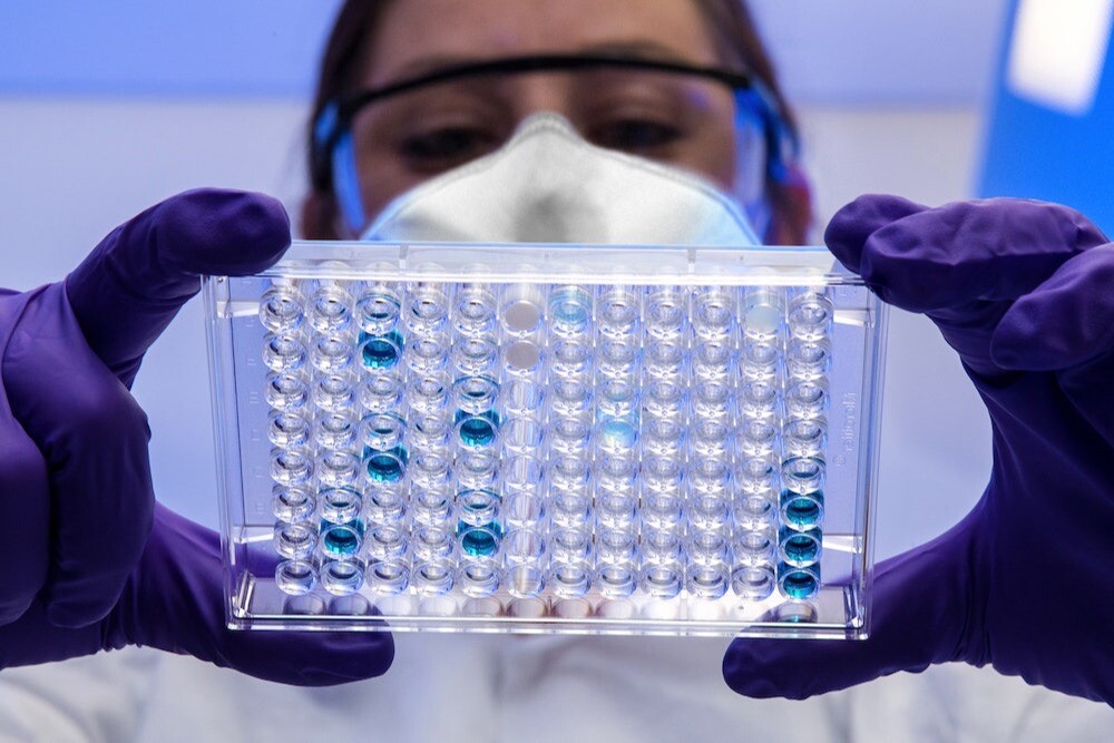 Российские ученые завершили доклинические испытания препарата против рака на основе вируса Ньюкасла