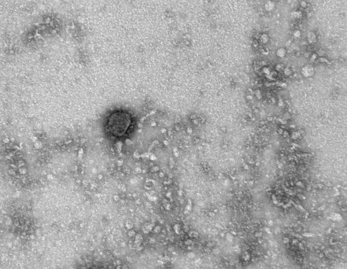 Коронавирус SARS-CoV-2 имел все возможности сформироваться в природе - эксперт