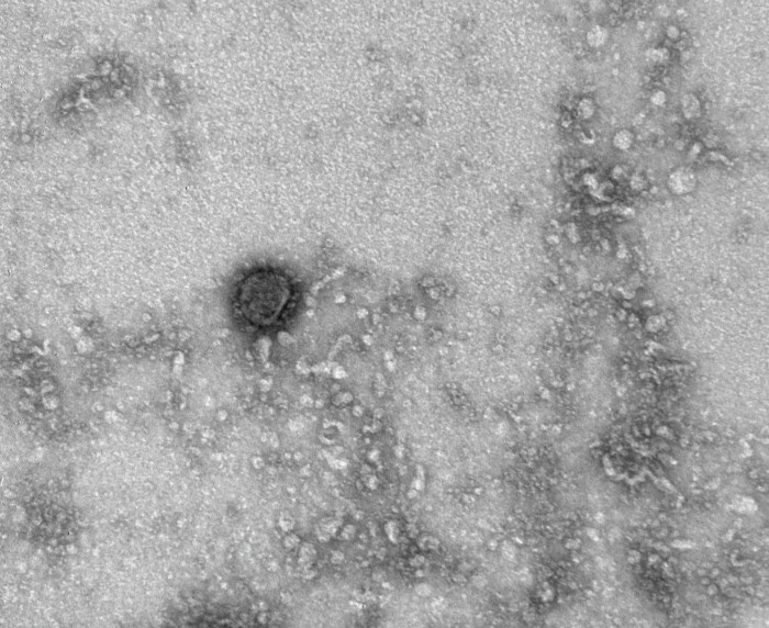 В Минобороны РФ заявили о возможной причастности США к появлению коронавируса