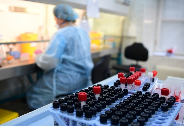 Заболеваемость скарлатиной увеличилась в 2,5 раза в Красноярском крае по сравнению с предыдущим годом - Роспотребнадзор