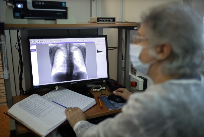 Заболеваемость туберкулезом в РФ упала на 42% за пять лет - Мурашко
